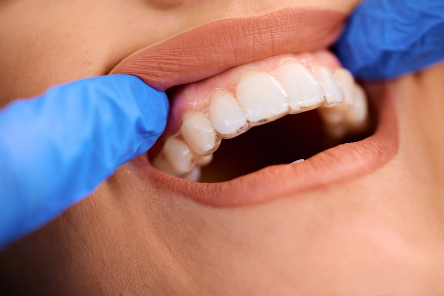 Orthodontic Treatment